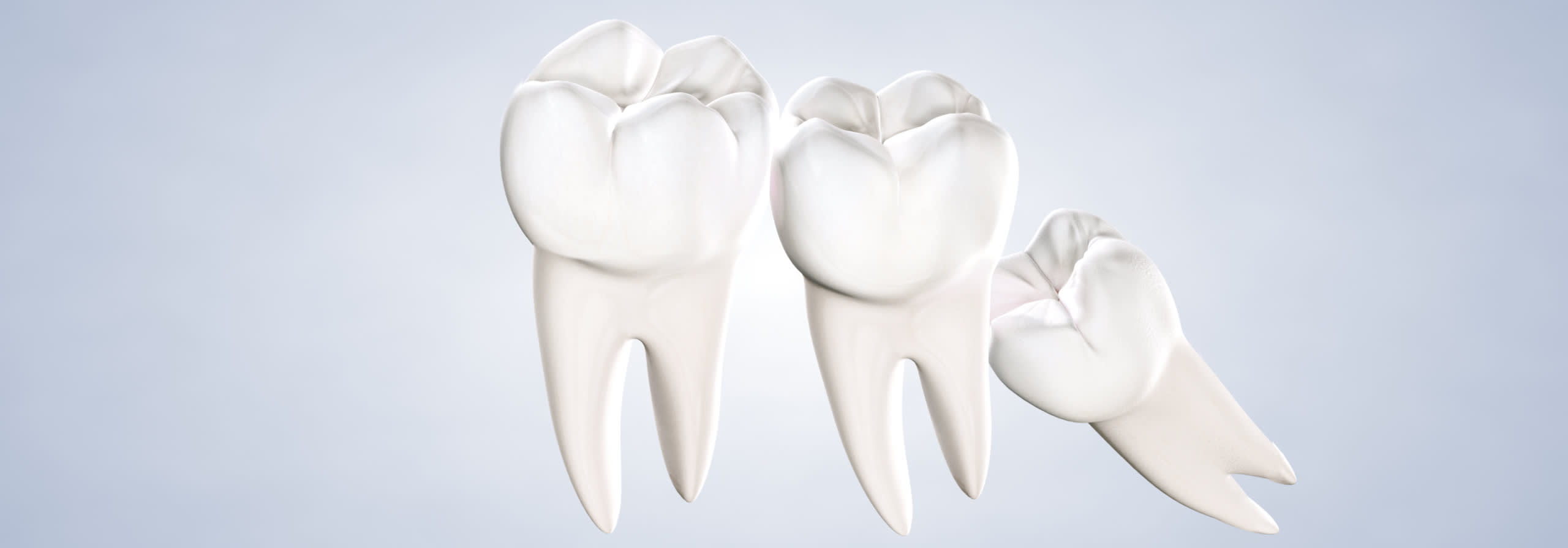 procedure  wisdom teeth removal  desktop